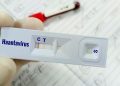 Warga Kulon Progo Suspek Virus Hanta Tidak Terkena Virus