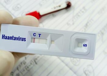 Warga Kulon Progo Suspek Virus Hanta Tidak Terkena Virus