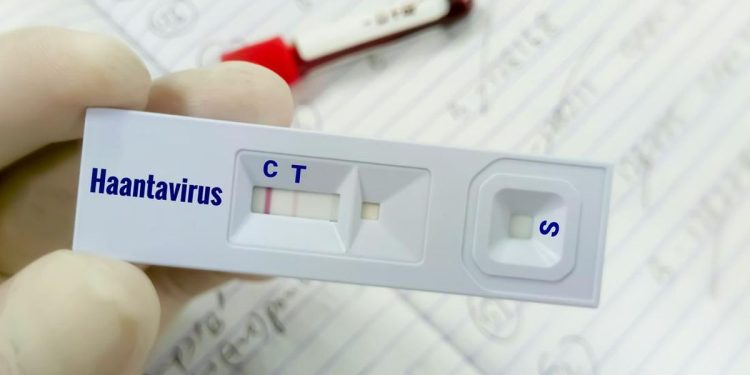 Warga Kulon Progo Suspek Virus Hanta Tidak Terkena Virus