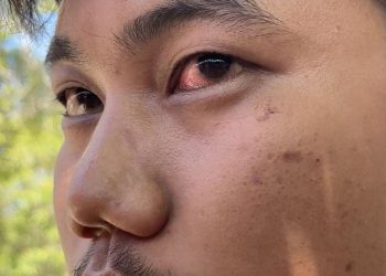 Insiden Jalan Raya Diduga Pengendara Dianiaya Direskrimum Polda Sumbar