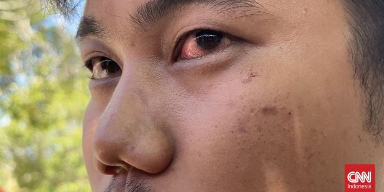 Insiden Jalan Raya Diduga Pengendara Dianiaya Direskrimum Polda Sumbar